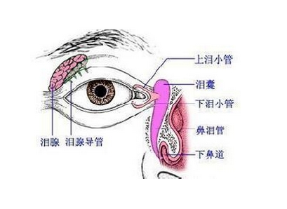 改良结膜囊鼻腔吻合+特制支架置入术